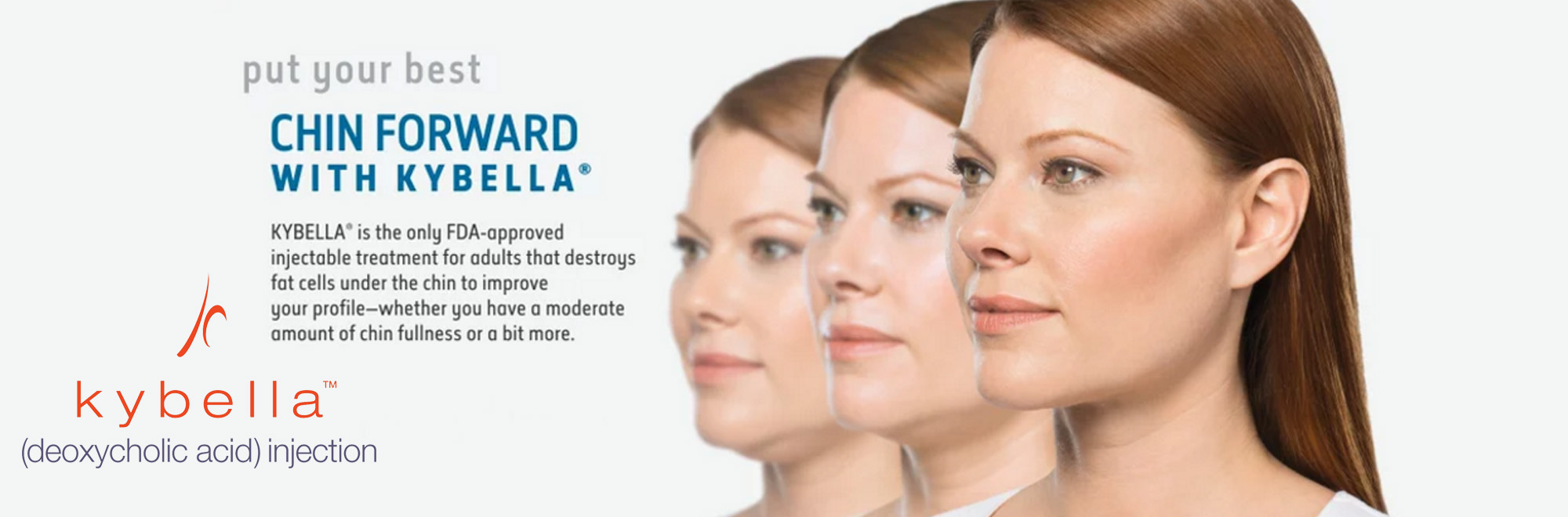 Kybella infographic